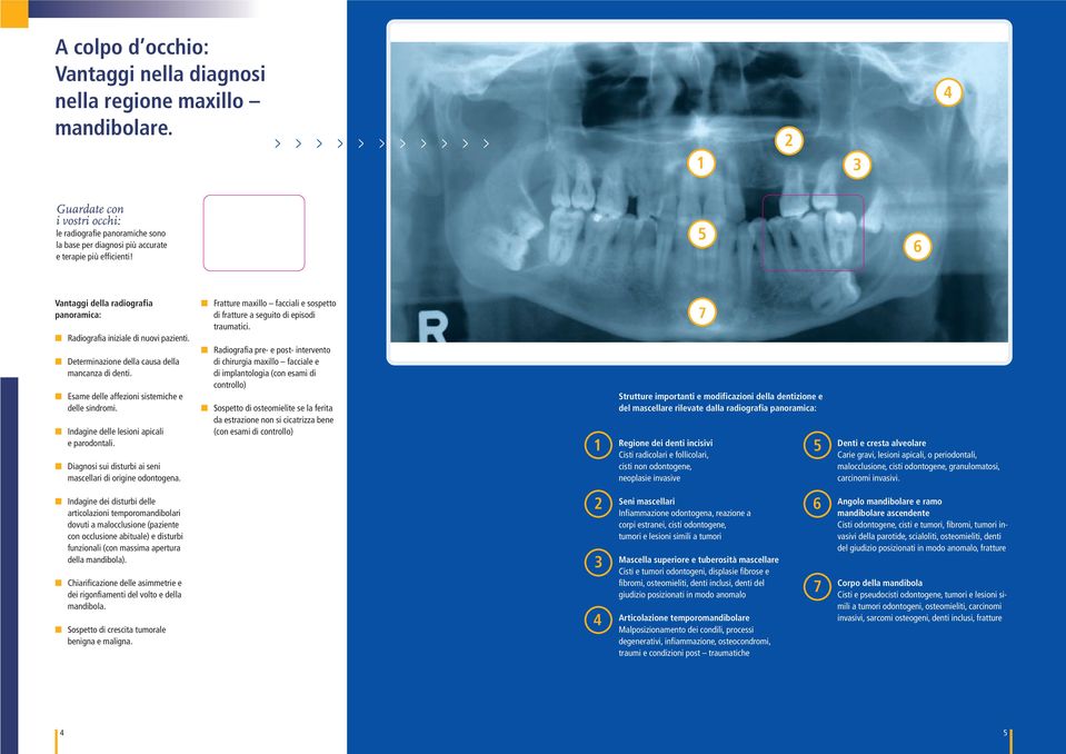 5 Vantaggi della radiografia panoramica: Radiografia iniziale di nuovi pazienti. Determinazione della causa della mancanza di denti. Esame delle affezioni sistemiche e delle sindromi.