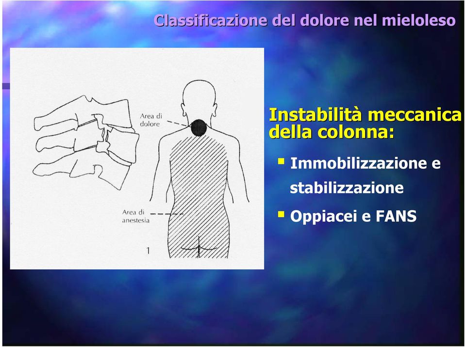 della colonna: Immobilizzazione