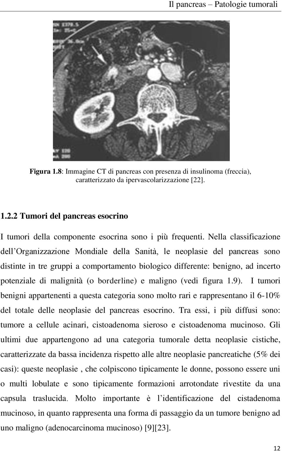 Nella classificazione dell Organizzazione Mondiale della Sanità, le neoplasie del pancreas sono distinte in tre gruppi a comportamento biologico differente: benigno, ad incerto potenziale di