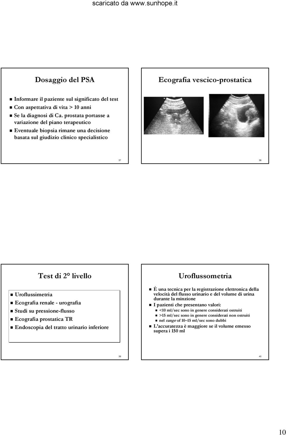 urografia Studi su pressione-flusso Ecografia prostatica TR Endoscopia del tratto urinario inferiore Uroflussometria È una tecnica per la registrazione elettronica della velocità del flusso urinario