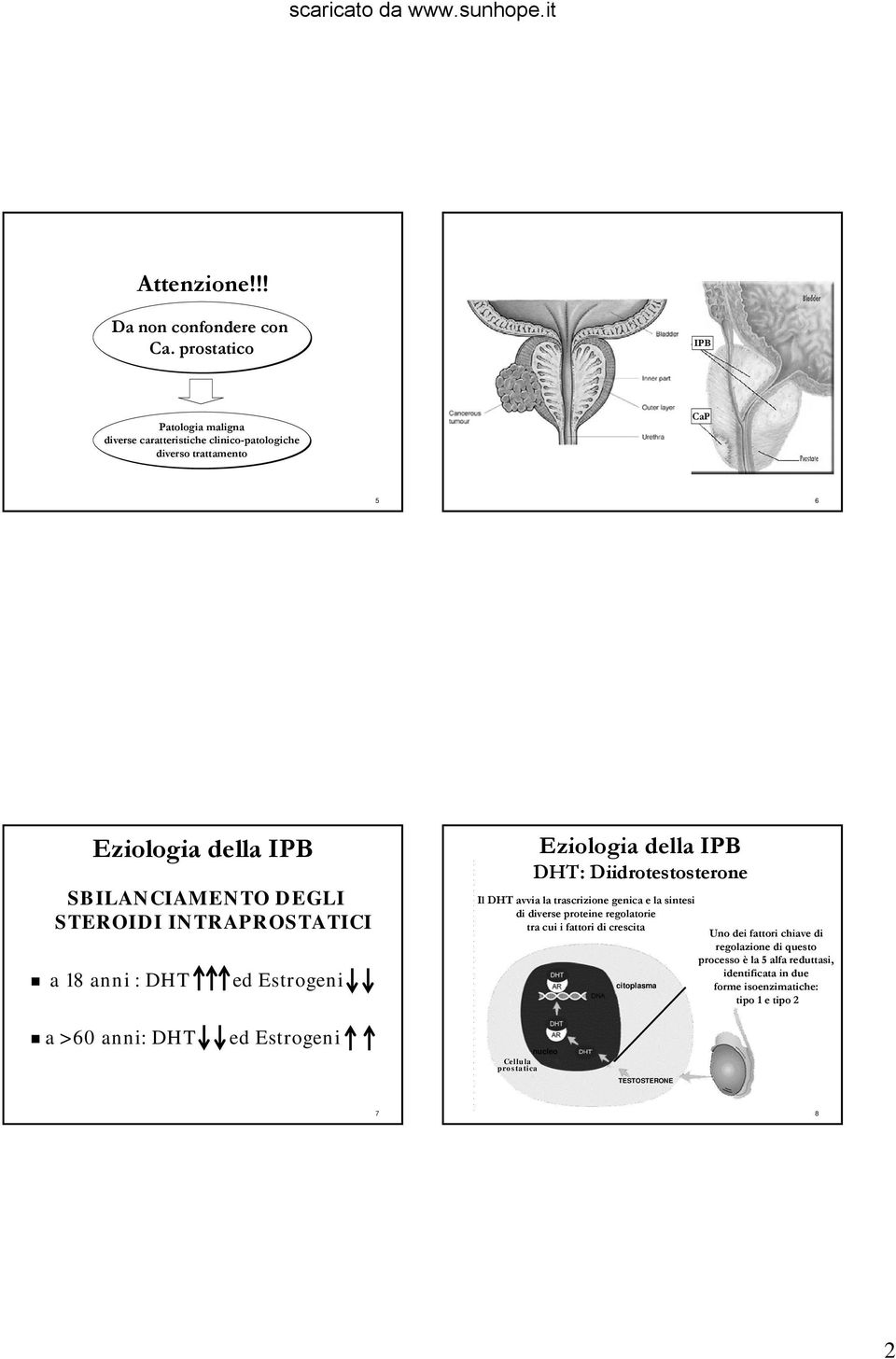 INTRAPROSTATICI a 18 anni : DHT ed Estrogeni Eziologia della IPB DHT: Diidrotestosterone Il DHT avvia la trascrizione genica e la sintesi di diverse