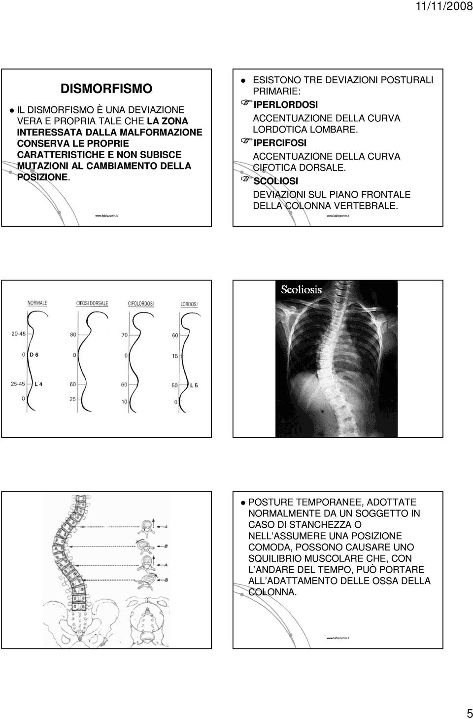 IPERCIFOSI ACCENTUAZIONE DELLA CURVA CIFOTICA DORSALE. SCOLIOSI DEVIAZIONI SUL PIANO FRONTALE DELLA COLONNA VERTEBRALE.