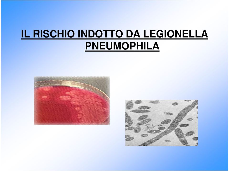 LEGIONELLA