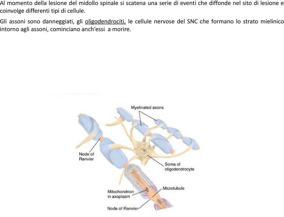 Gli assoni sono danneggiati, gli oligodendrociti, le cellule nervose del SNC