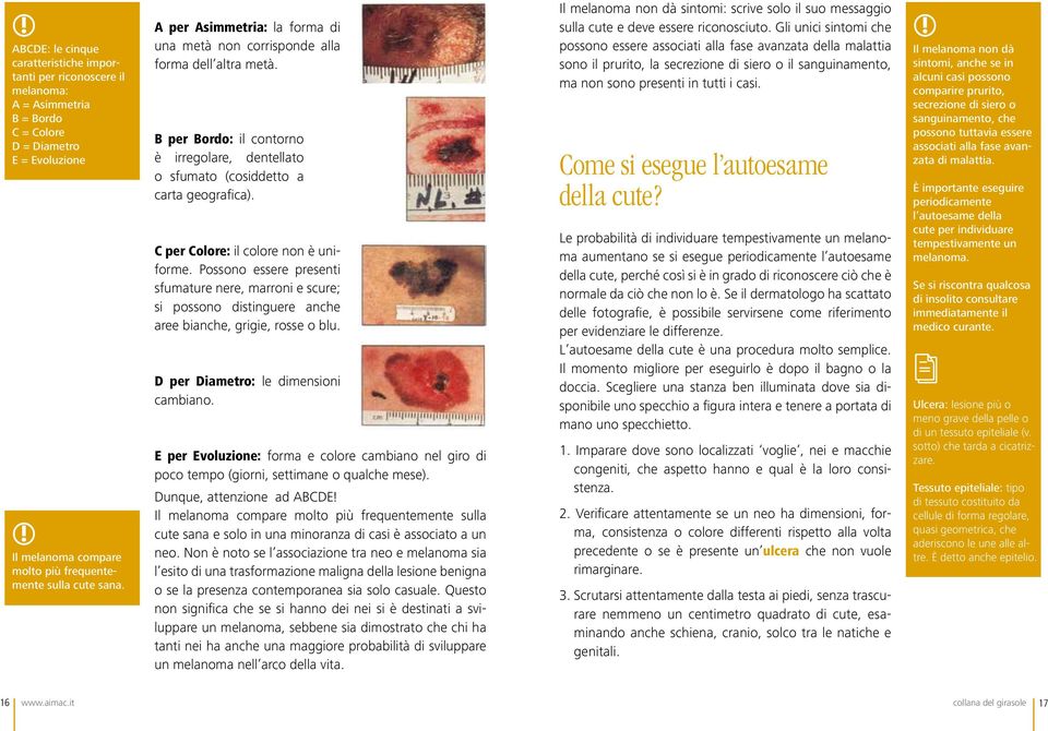 C per Colore: il colore non è uniforme. Possono essere presenti sfumature nere, marroni e scure; si possono distinguere anche aree bianche, grigie, rosse o blu. D per Diametro: le dimensioni cambiano.