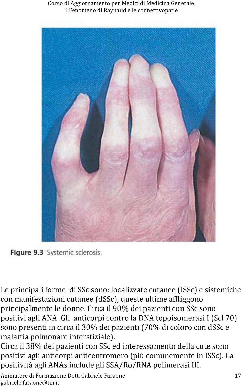 Gli anticorpi contro la DNA topoisomerasi I (Scl 70) sono presenti in circa il 30% dei pazienti (70% di coloro con dssc e malattia polmonare