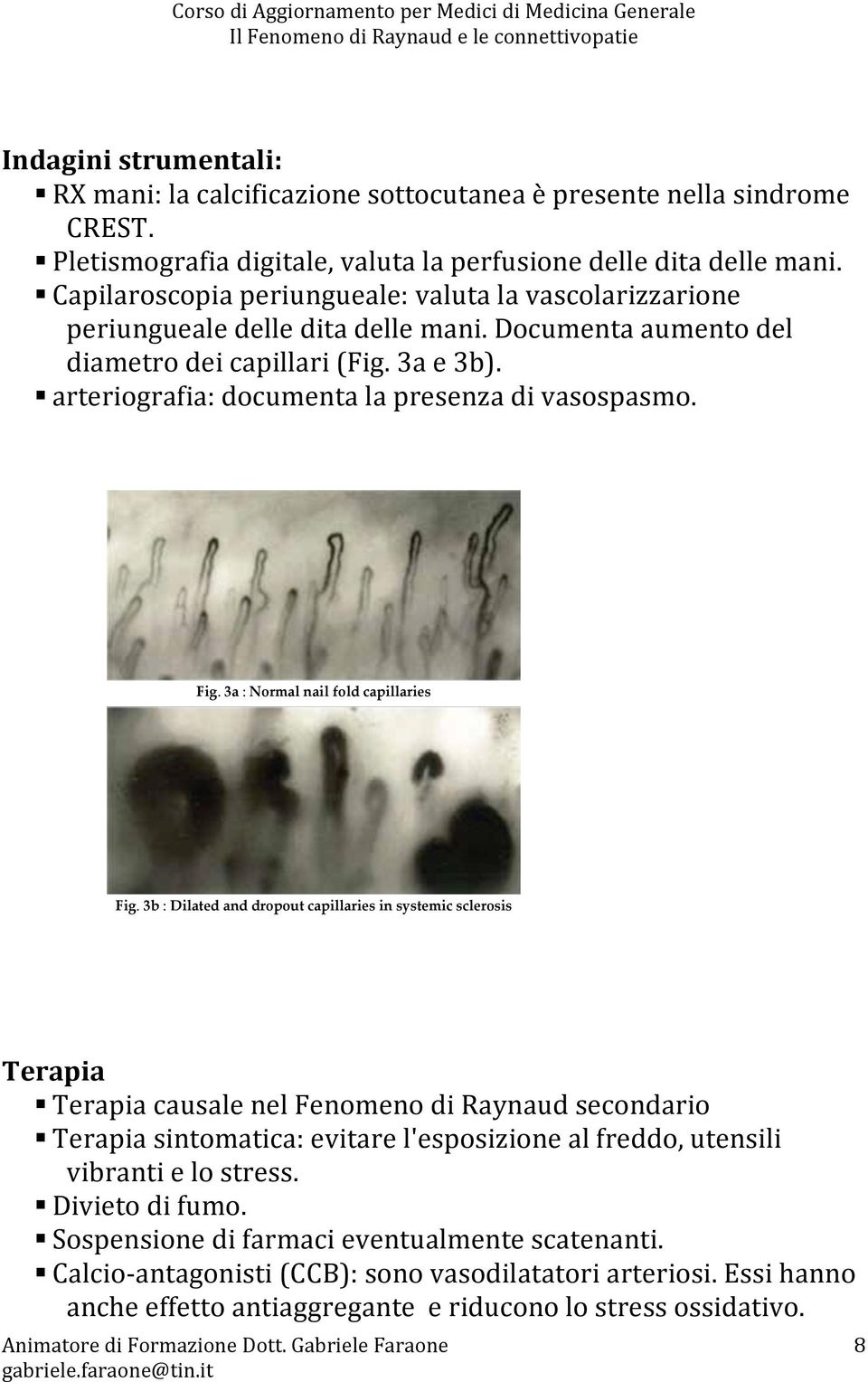 arteriografia: documenta la presenza di vasospasmo. Fig. 3a : Normal nail fold capillaries Fig.