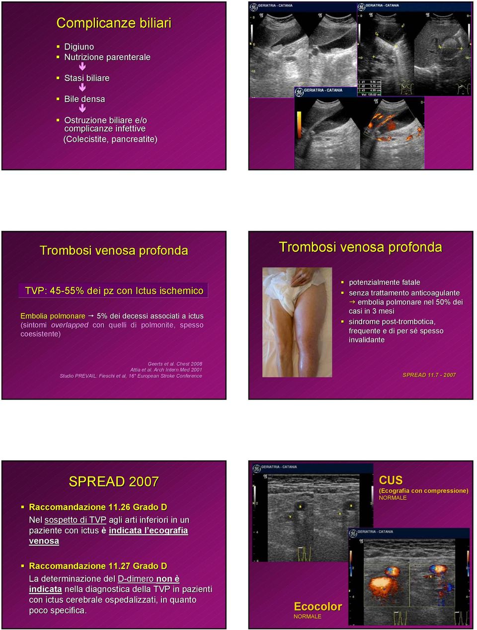 anticoagulante embolia polmonare nel 50% dei casi in 3 mesi sindrome post-trombotica, frequente e di per sé s spesso invalidante Geerts et al. Chest 2008 Attia et al.