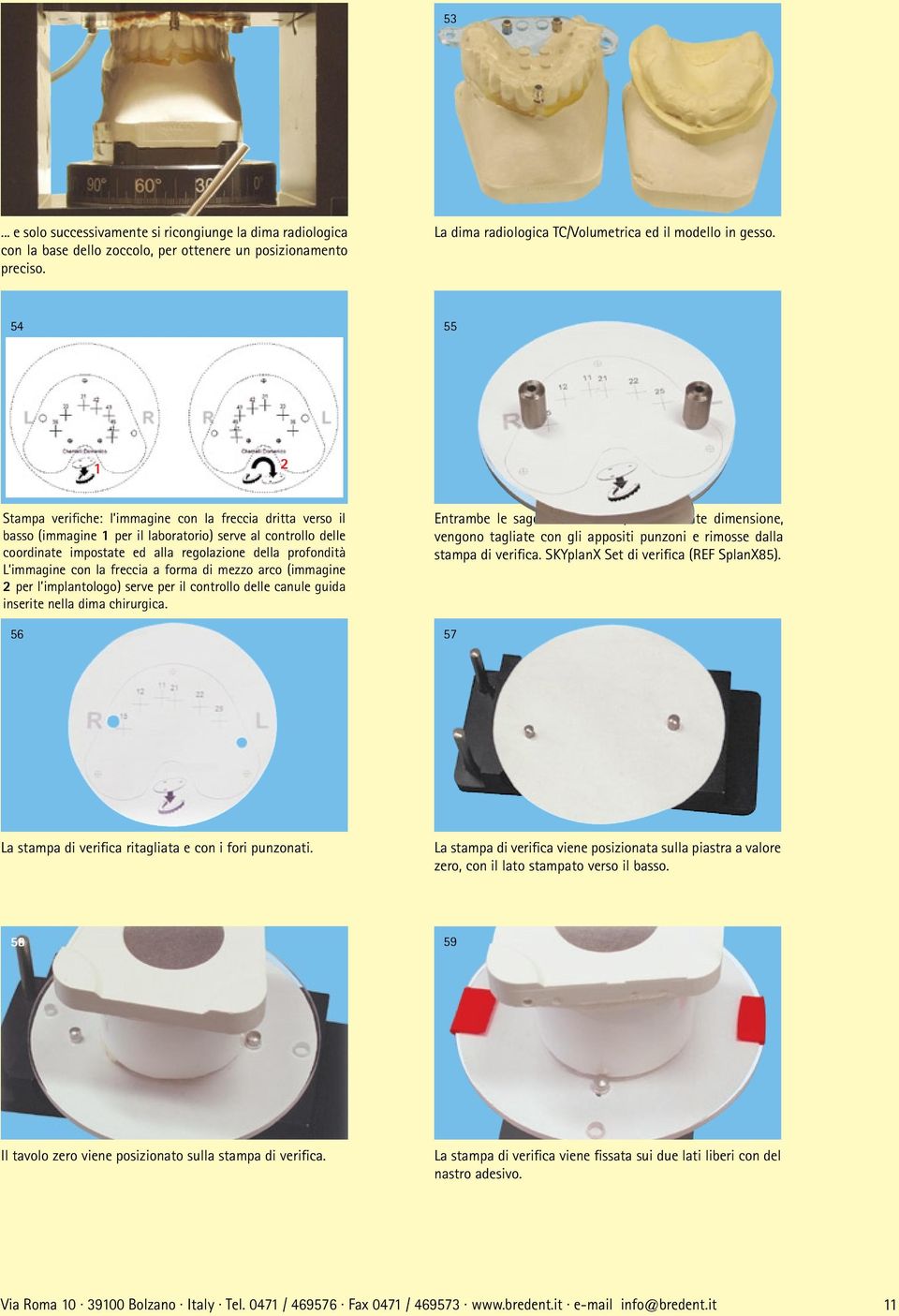 immagine con la freccia a forma di mezzo arco (immagine 2 per l implantologo) serve per il controllo delle canule guida inserite nella dima chirurgica.