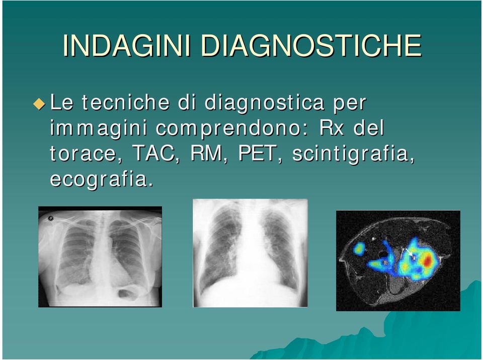 immagini comprendono: Rx del