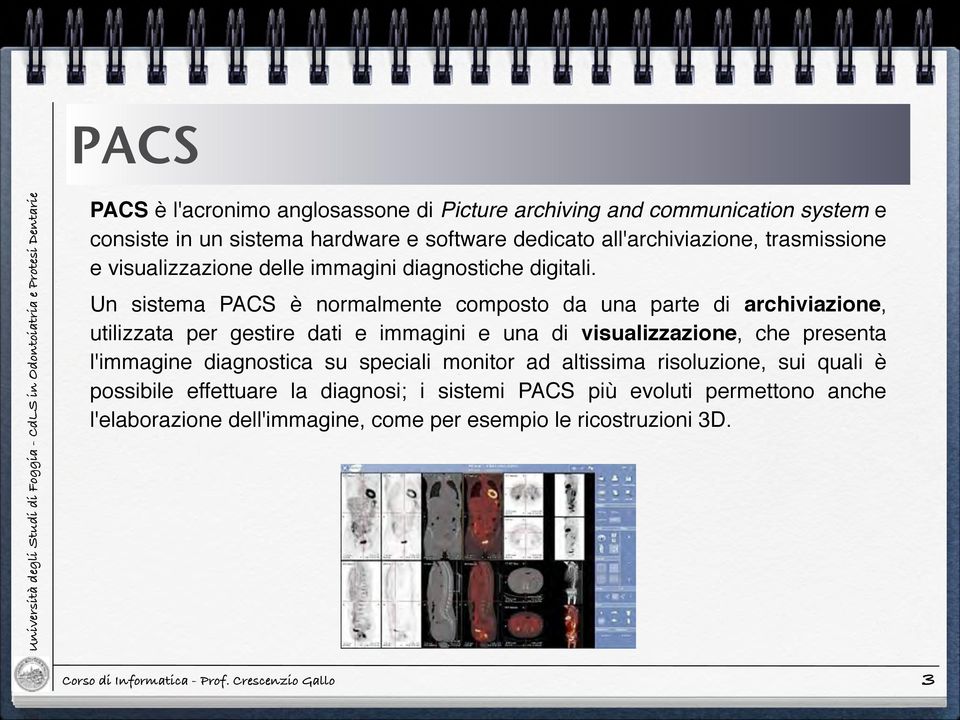 ! Un sistema PACS è normalmente composto da una parte di archiviazione, utilizzata per gestire dati e immagini e una di visualizzazione, che presenta
