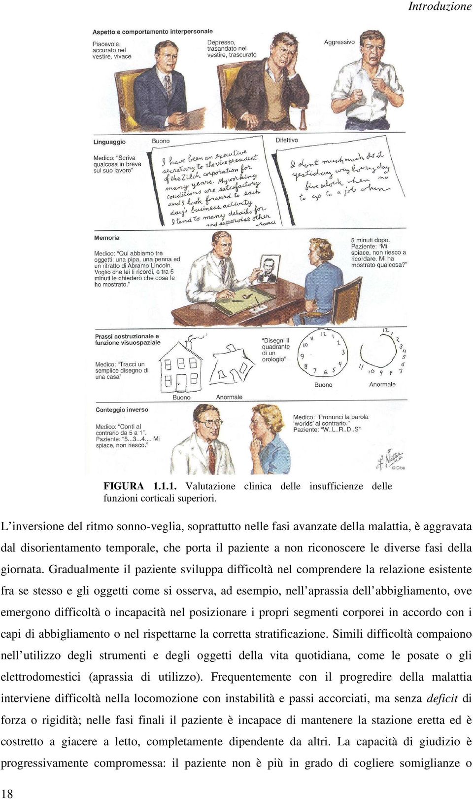 Gradualmente il paziente sviluppa difficoltà nel comprendere la relazione esistente fra se stesso e gli oggetti come si osserva, ad esempio, nell aprassia dell abbigliamento, ove emergono difficoltà