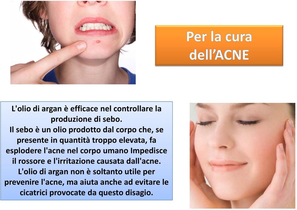 esplodere l'acne nel corpo umano Impedisce ilrossore e l'irritazione causata dall'acne.