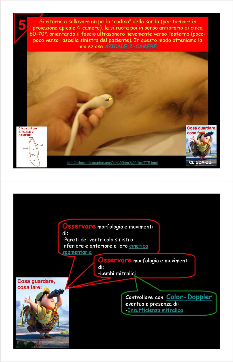 In questo modo otteniamo la proiezione APICALE 2-CAMERE Clicca qui per APICALE 2- CAMERE cosa fare http://echocardiographer.org/old%20html%20files/tte.