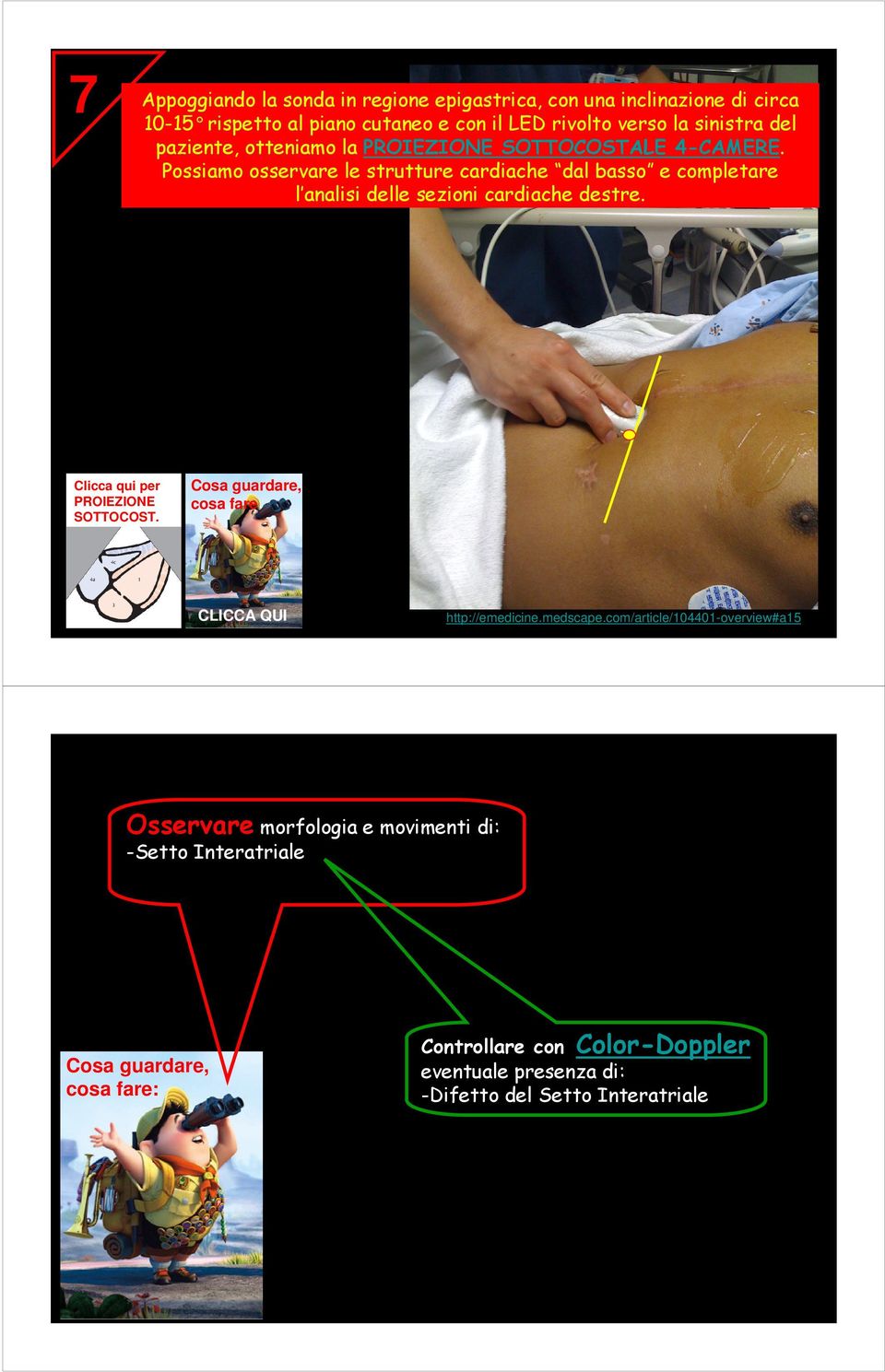 Possiamo osservare le strutture cardiache dal basso e completare l analisi delle sezioni cardiache destre. Clicca qui per PROIEZIONE SOTTOCOST.