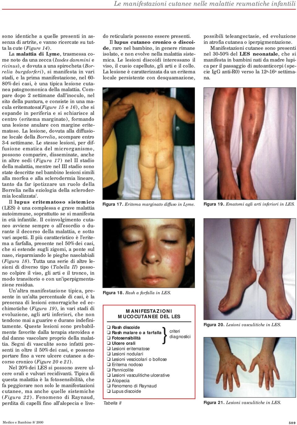 dei casi, è una tipica lesione cutanea patognomonica della malattia.