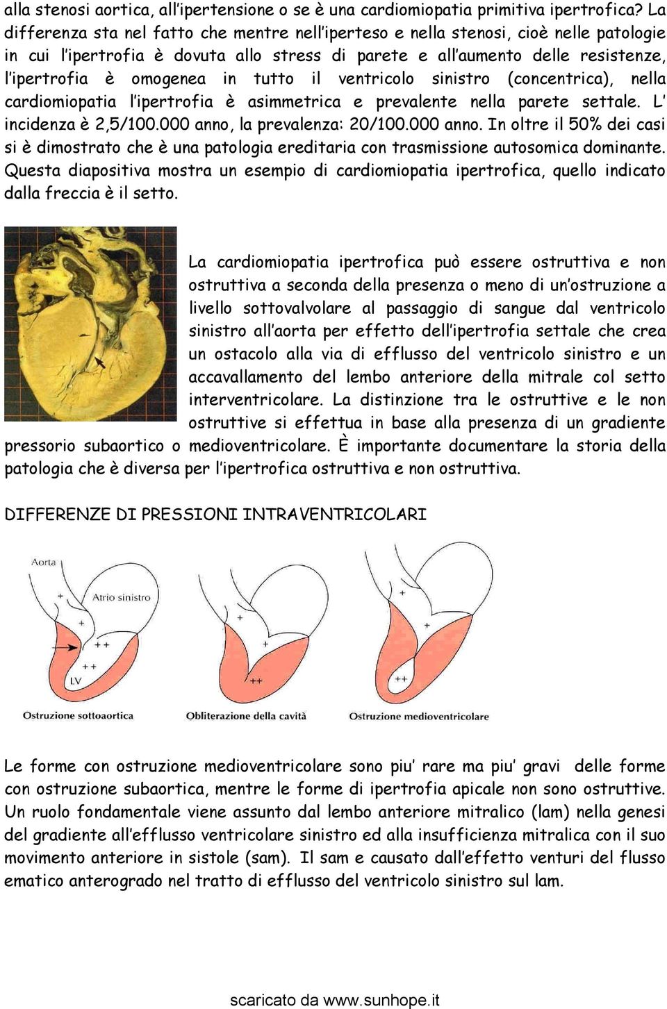 in tutto il ventricolo sinistro (concentrica), nella cardiomiopatia l ipertrofia è asimmetrica e prevalente nella parete settale. L incidenza è 2,5/100.000 anno,