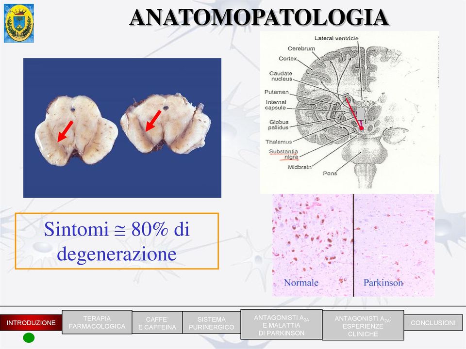 INTRODUZIONE TERAPIA FARMACOLOGICA CAFFE E CAFFEINA SISTEMA PURINERGICO