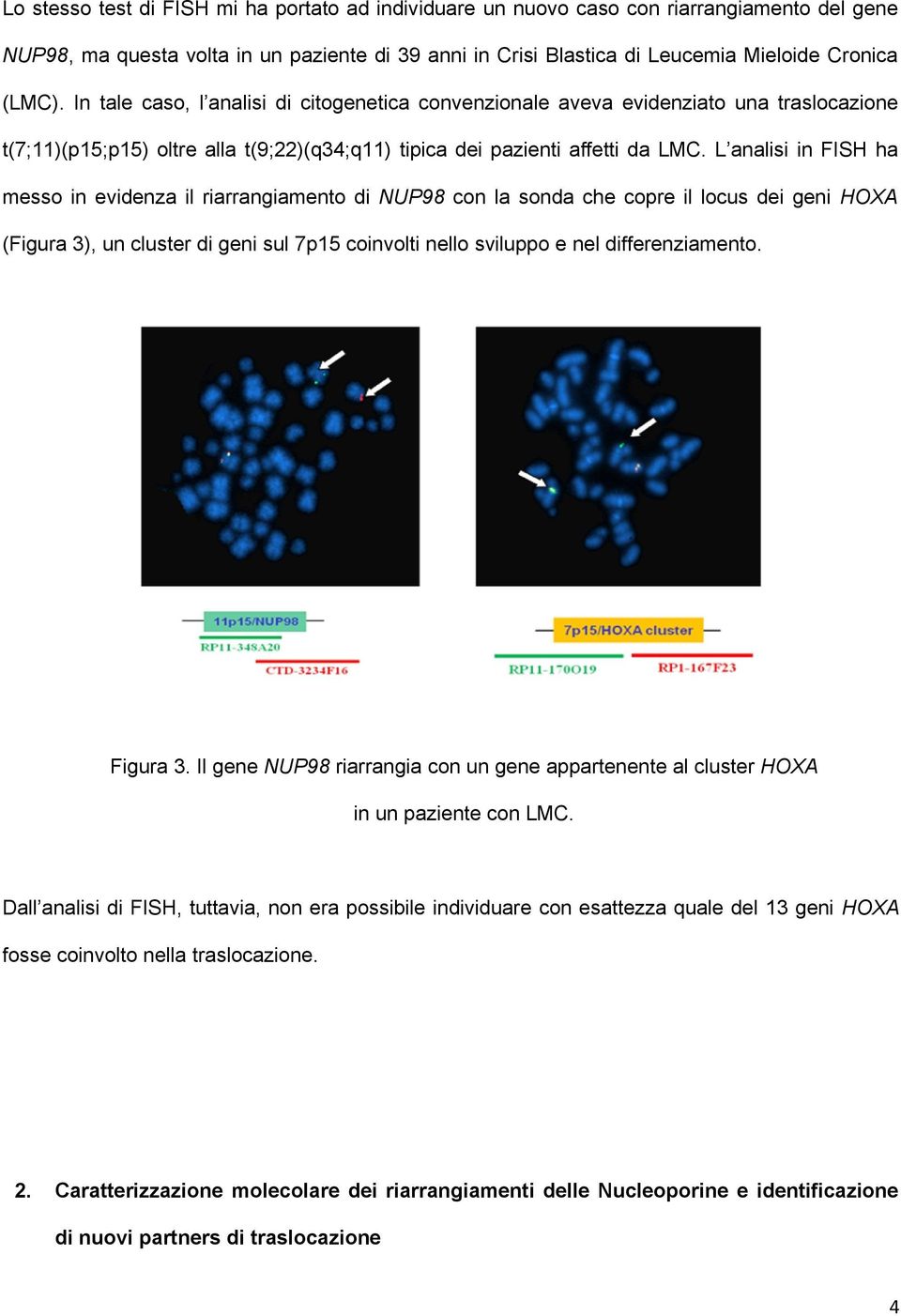 L analisi in FISH ha messo in evidenza il riarrangiamento di NUP98 con la sonda che copre il locus dei geni HOXA (Figura 3), un cluster di geni sul 7p15 coinvolti nello sviluppo e nel
