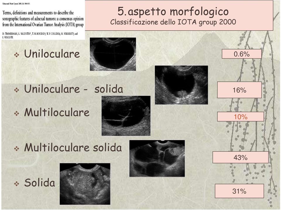 6% Uniloculare - solida Multiloculare