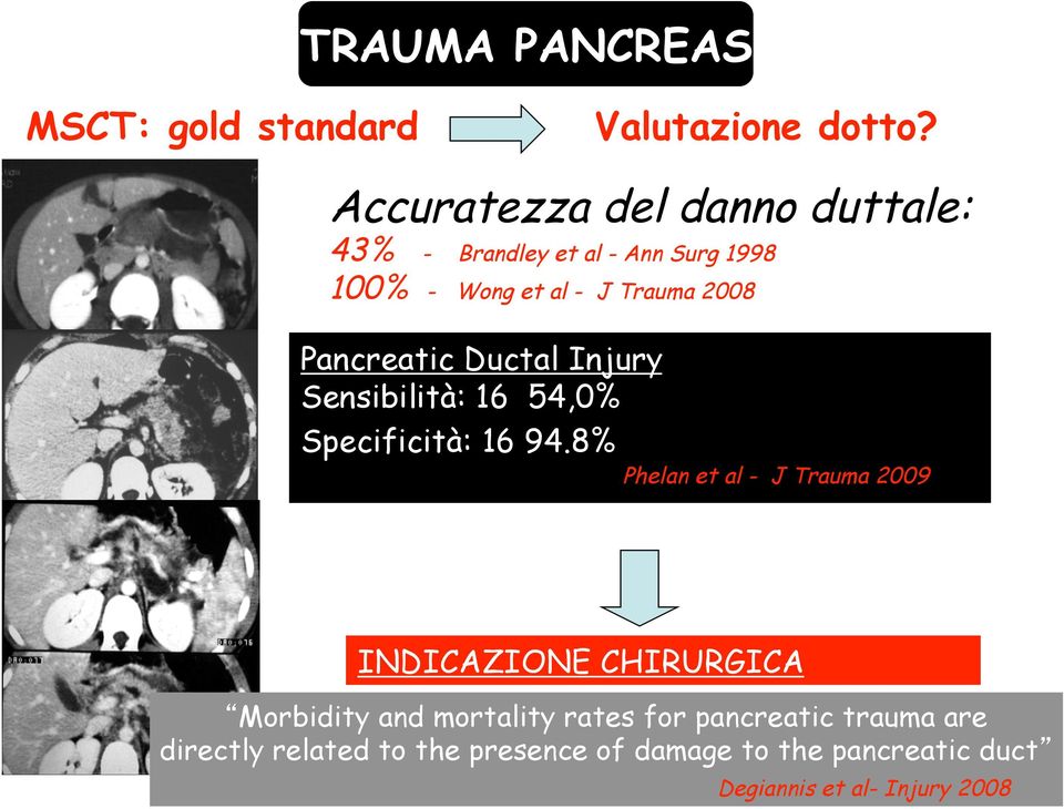 Pancreatic Ductal Injury Sensibilità: 16 54,0% Specificità: 16 94.
