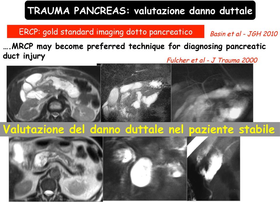 MRCP may become preferred technique for diagnosing pancreatic duct