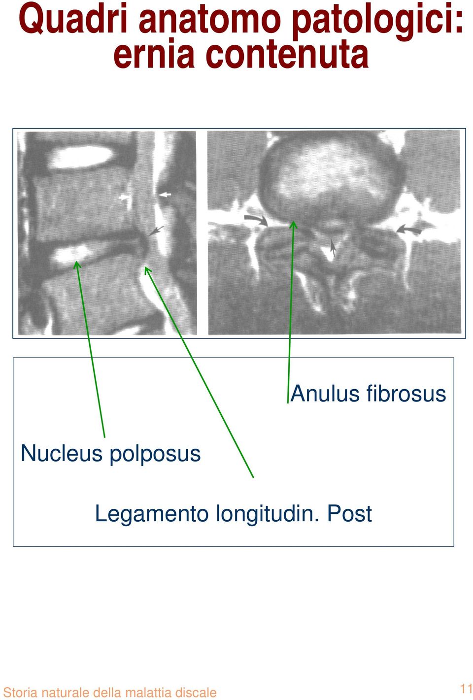 fibrosus longitudin.