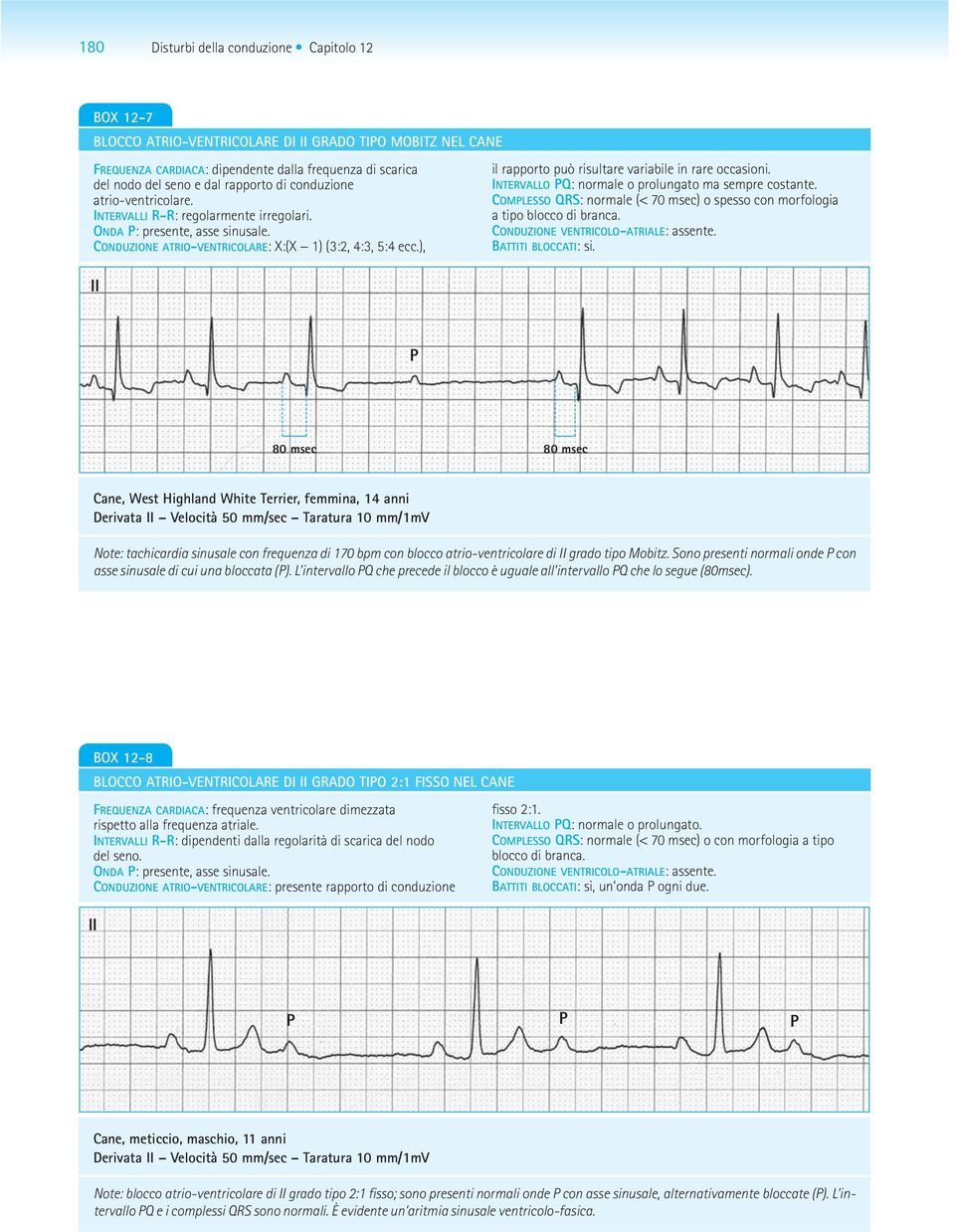 INTERVALLO Q: normale o prolungato ma sempre costante. COMLESSO QRS: normale (< 70 msec) o spesso con morfologia a tipo blocco di branca. BATTITI BLOCCATI: si.