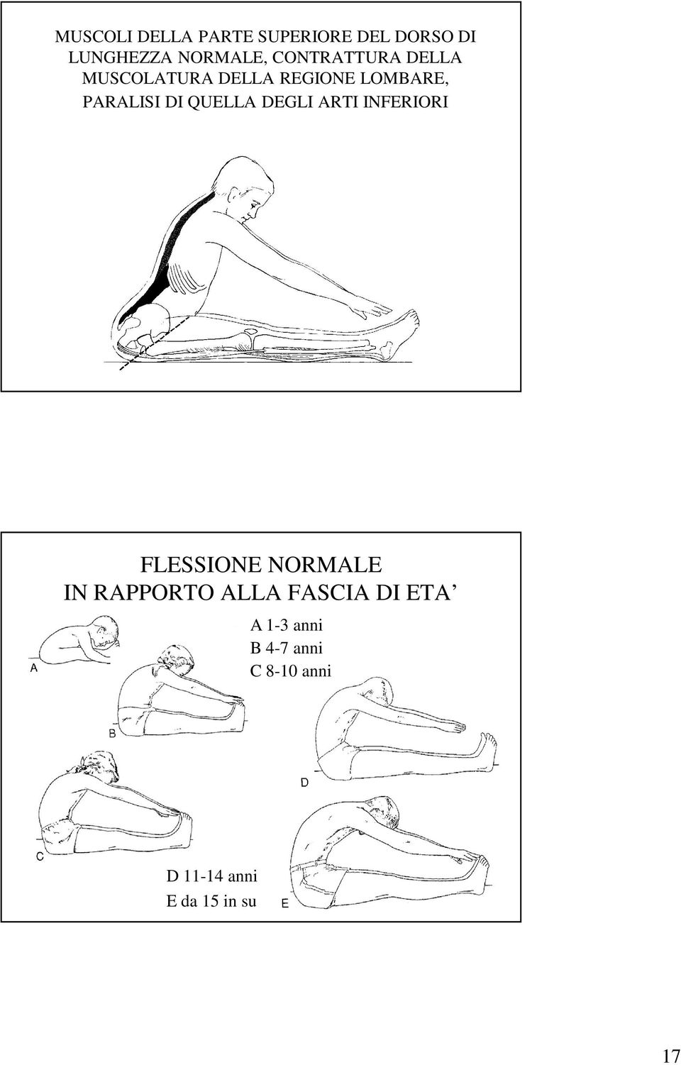 QUELLA DEGLI ARTI INFERIORI FLESSIONE NORMALE IN RAPPORTO ALLA