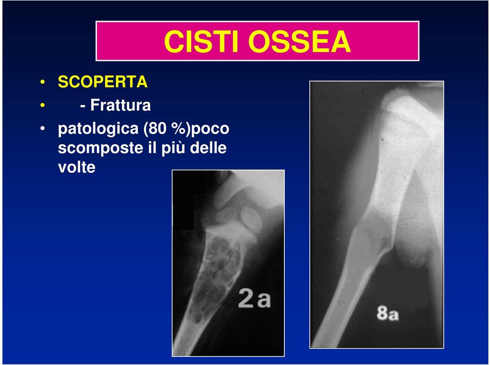 %)poco scomposte il