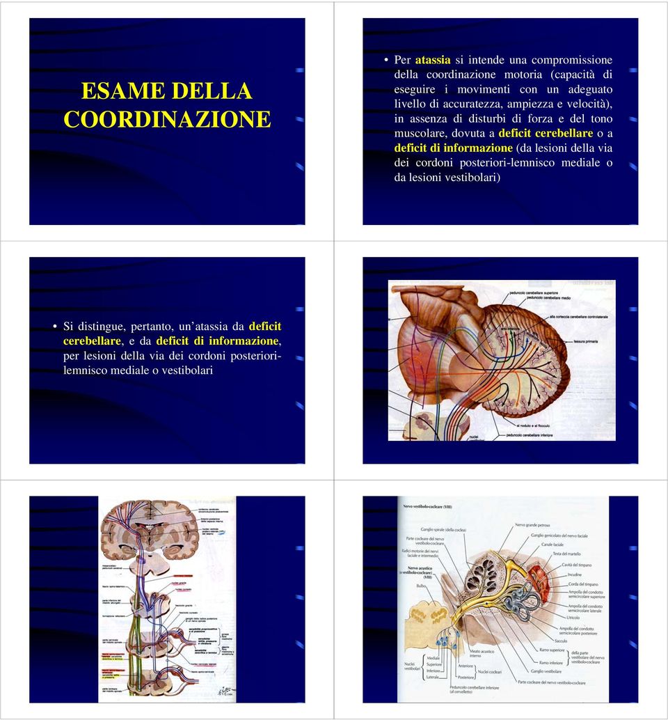 o a deficit di informazione (da lesioni della via dei cordoni posteriori-lemnisco mediale o da lesioni vestibolari) Si distingue,