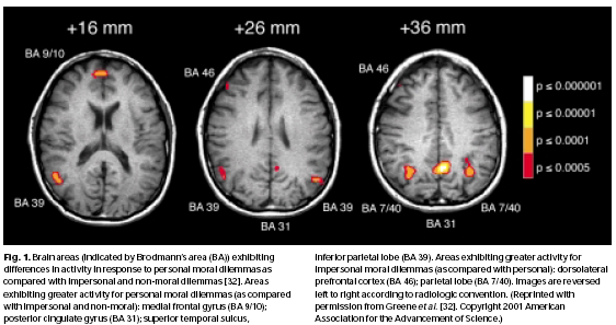 Giudizi personali Giudizi impersonali Aree cerebrali (Brodmann) coinvolte nei giudizi morali personali e impersonali.
