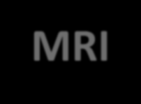 MRI: marcata dilatazione dei