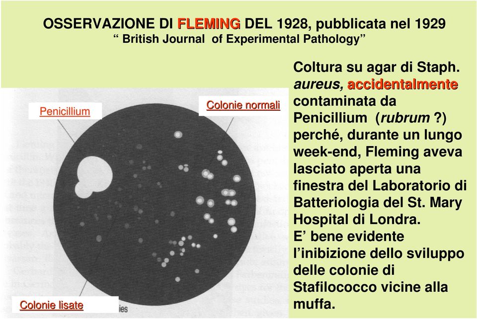 ) perché, durante un lungo week-end, Fleming aveva lasciato aperta una finestra del Laboratorio di Batteriologia