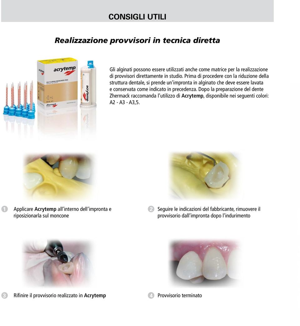 Dopo la preparazione del dente Zhermack raccomanda l utilizzo di Acrytemp, disponibile nei seguenti colori: A2 - A3 - A3,5.