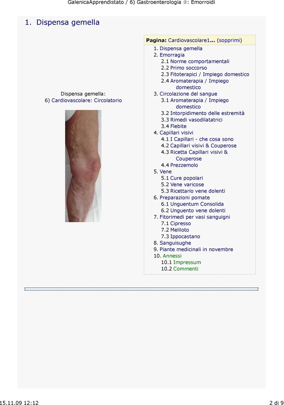 4 Flebite 4. Capillari visivi 4.1 I Capillari - che cosa sono 4.2 Capillari visivi & Couperose 4.3 Ricetta Capillari visivi & Couperose 4.4 Prezzemolo 5. Vene 5.1 Cure popolari 5.2 Vene varicose 5.