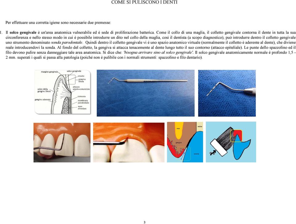 (a scopo diagnostico), può introdurre dentro il colletto gengivale uno strumento denominato sonda parodontale.