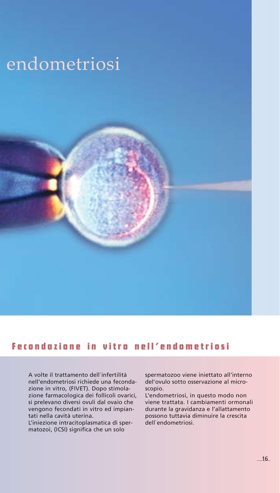 L iniezione intracitoplasmatica di spermatozoi, (ICSI) significa che un solo spermatozoo viene iniettato all interno del ovulo sotto osservazione al microscopio.