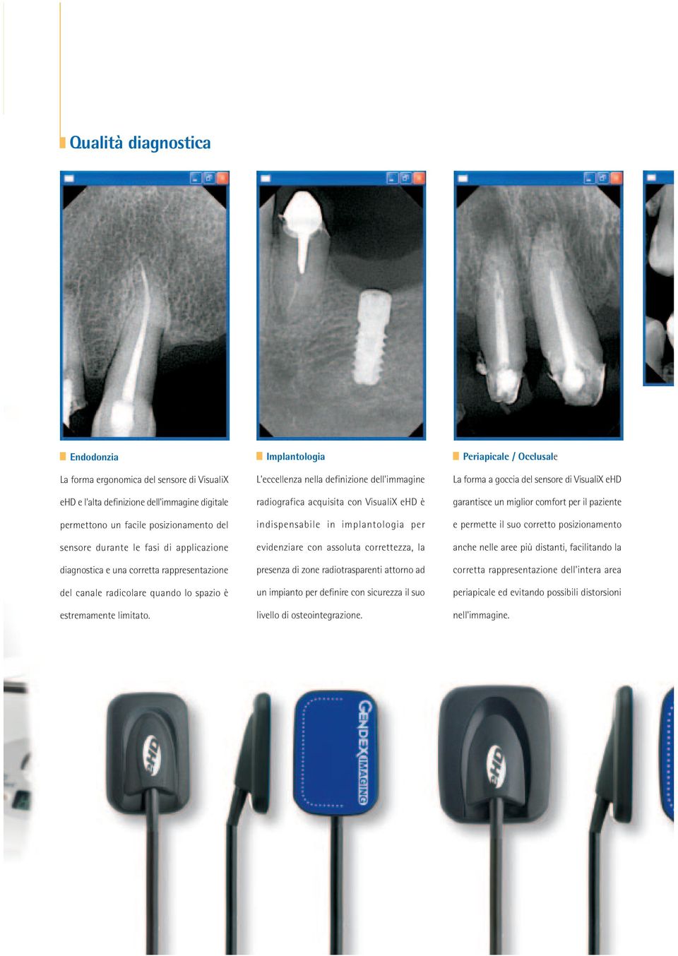 Implantologia L'eccellenza nella definizione dell'immagine radiografica acquisita con VisualiX ehd è indispensabile in implantologia per evidenziare con assoluta correttezza, la presenza di zone