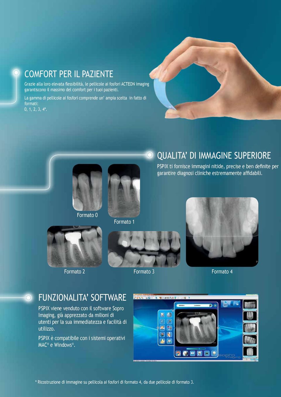 QUALITA DI IMMAGINE SUPERIORE PSPIX ti fornisce immagini nitide, precise e ben definite per garantire diagnosi cliniche estremamente affidabili.