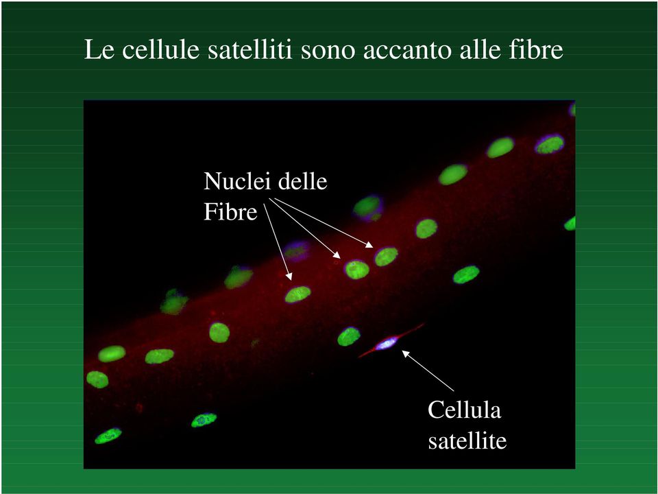 Nuclei delle Fibre