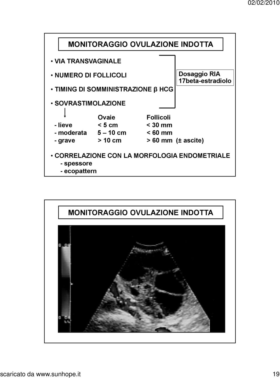 mm - moderata 5 10 cm < 60 mm - grave > 10 cm > 60 mm (± ascite) CORRELAZIONE CON LA MORFOLOGIA