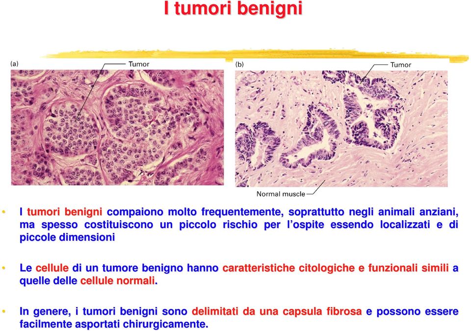 tumore benigno hanno caratteristiche citologiche e funzionali simili a quelle delle cellule normali.