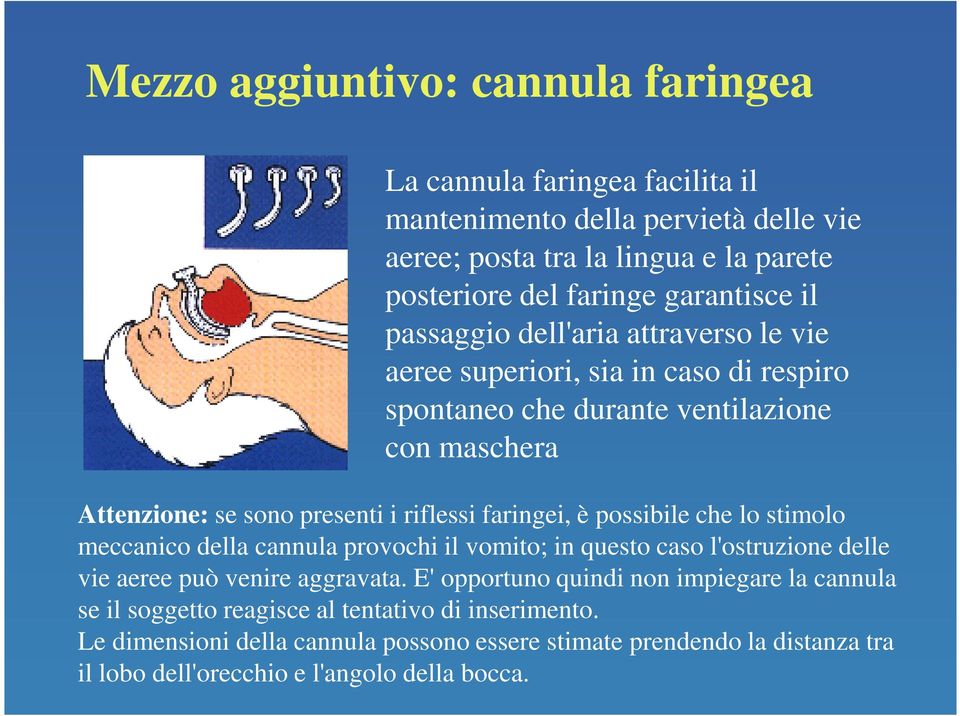 è possibile che lo stimolo meccanico della cannula provochi il vomito; in questo caso l'ostruzione delle vie aeree può venire aggravata.