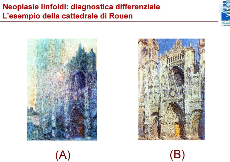 differenziale L