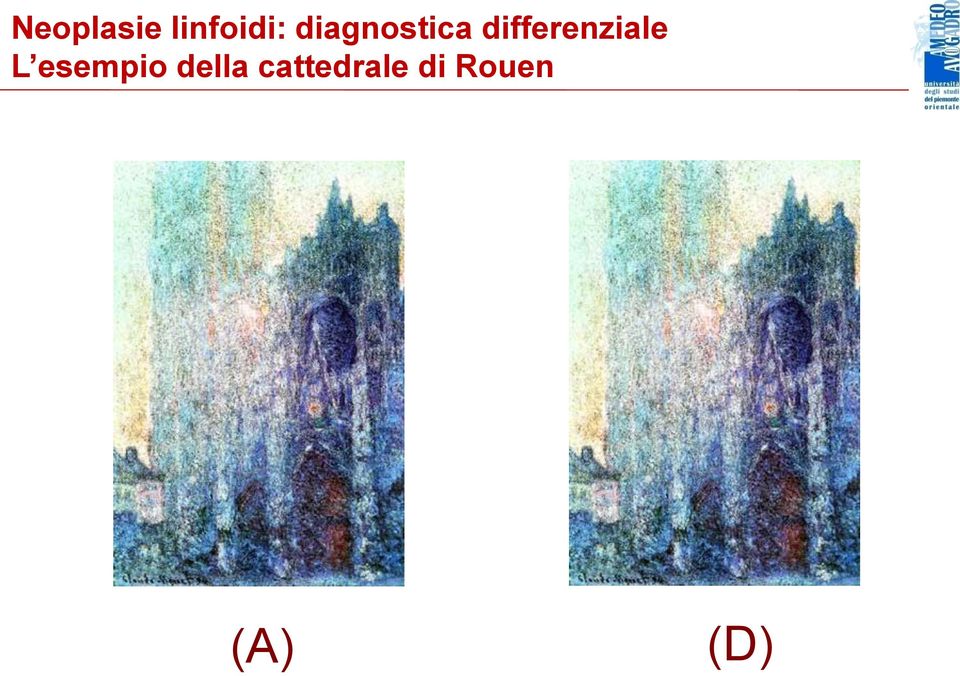 differenziale L