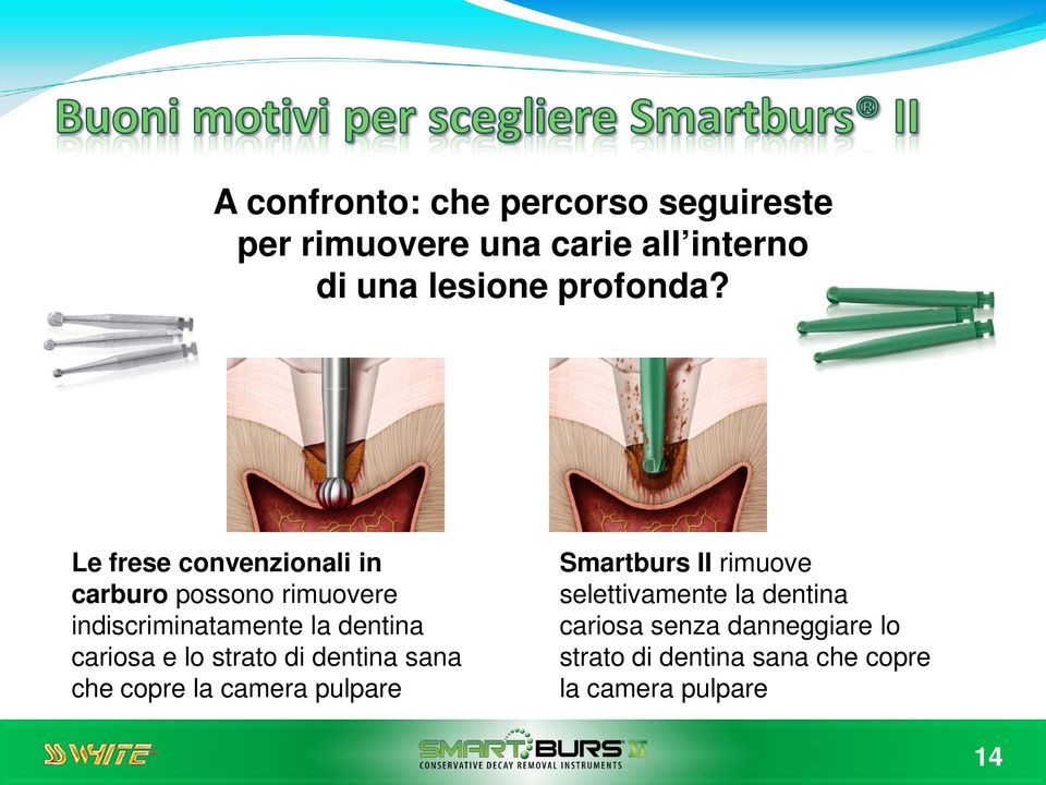 Le frese convenzionali in carburo possono rimuovere indiscriminatamente la dentina cariosa e