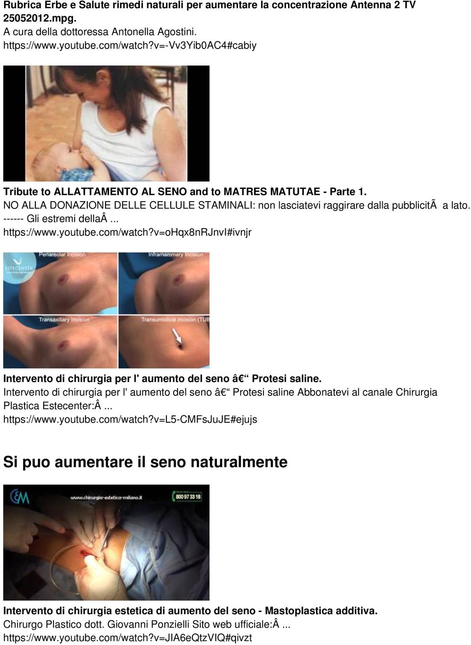 ------ Gli estremi dellaâ... https://www.youtube.com/watch?v=ohqx8nrjnvi#ivnjr Intervento di chirurgia per l' aumento del seno â Protesi saline.