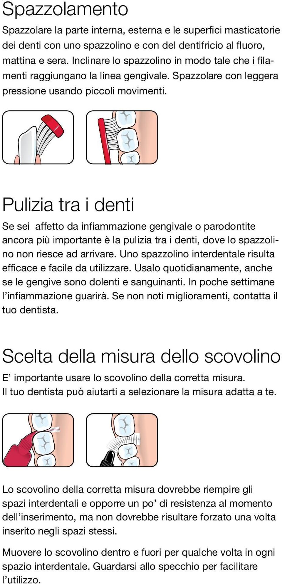 Pulizia tra i denti Se sei affetto da infiammazione gengivale o parodontite ancora più importante è la pulizia tra i denti, dove lo spazzolino non riesce ad arrivare.