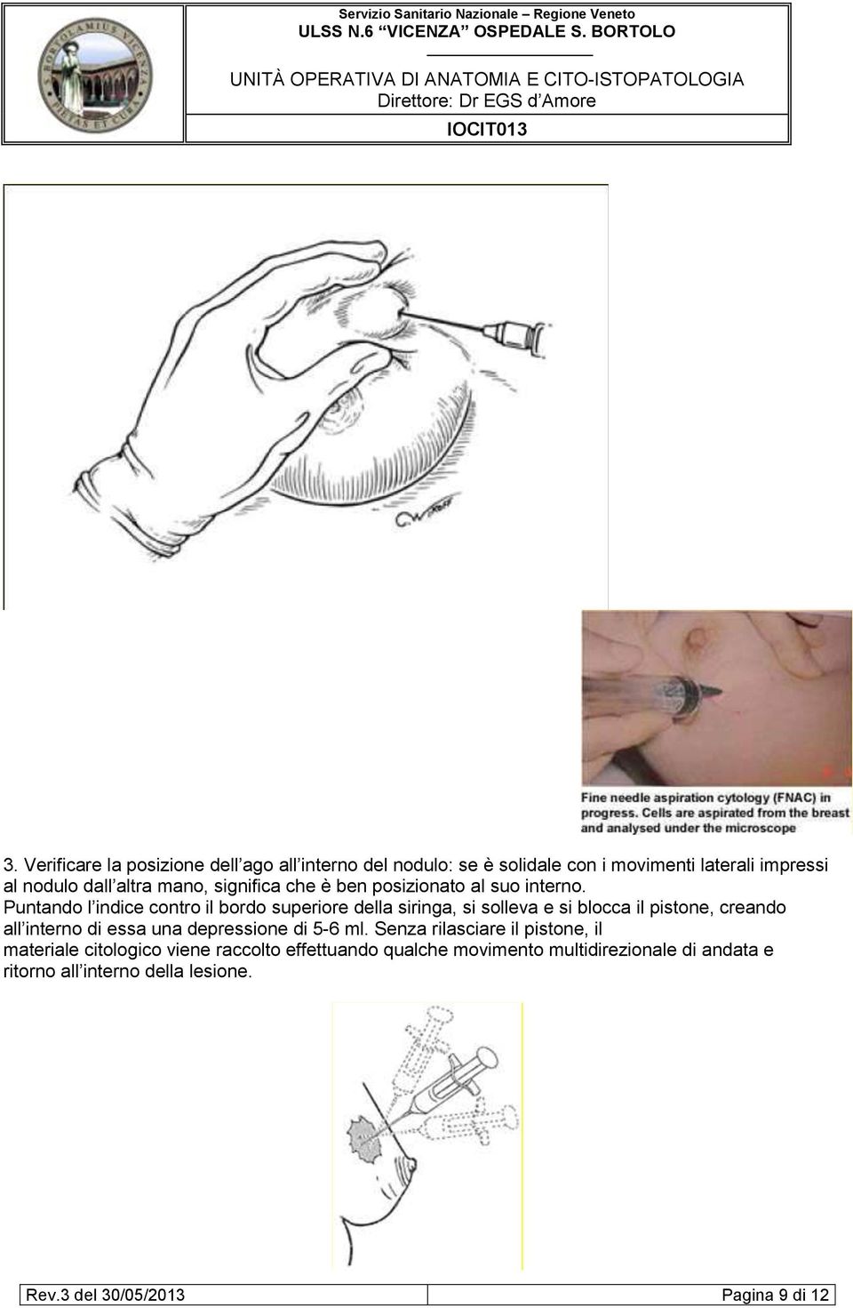 Puntando l indice contro il bordo superiore della siringa, si solleva e si blocca il pistone, creando all interno di essa una